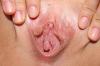 arges
